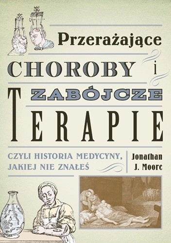 Przerażające choroby i zabójcze terapie, czyli historia medycyny, jakiej nie znałeś