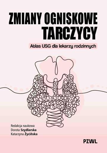 Zmiany ogniskowe tarczycy. Atlas USG dla lekarzy rodzinnych