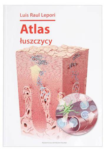 Atlas łuszczycy