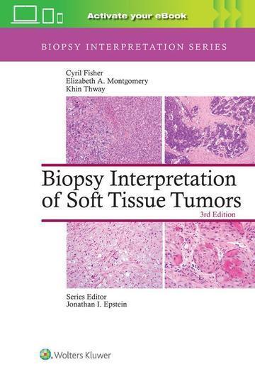 Biopsy Interpretation of Soft Tissue Tumors: Print + eBook with Multimedia