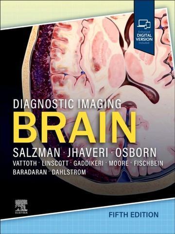 Diagnostic Imaging . Brain
