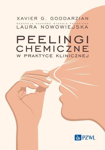 Peelingi chemiczne w praktyce klinicznej