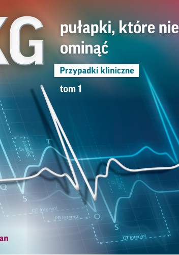 Pułapki EKG, które niełatwo ominąć część I