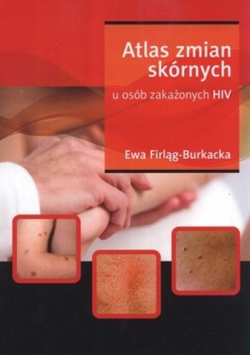 Atlas zmian skórnych u osób zakażonych HIV